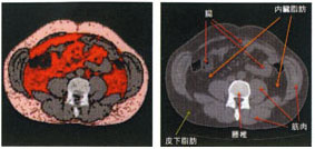 CTを活用したFAT SCANの画面参考例